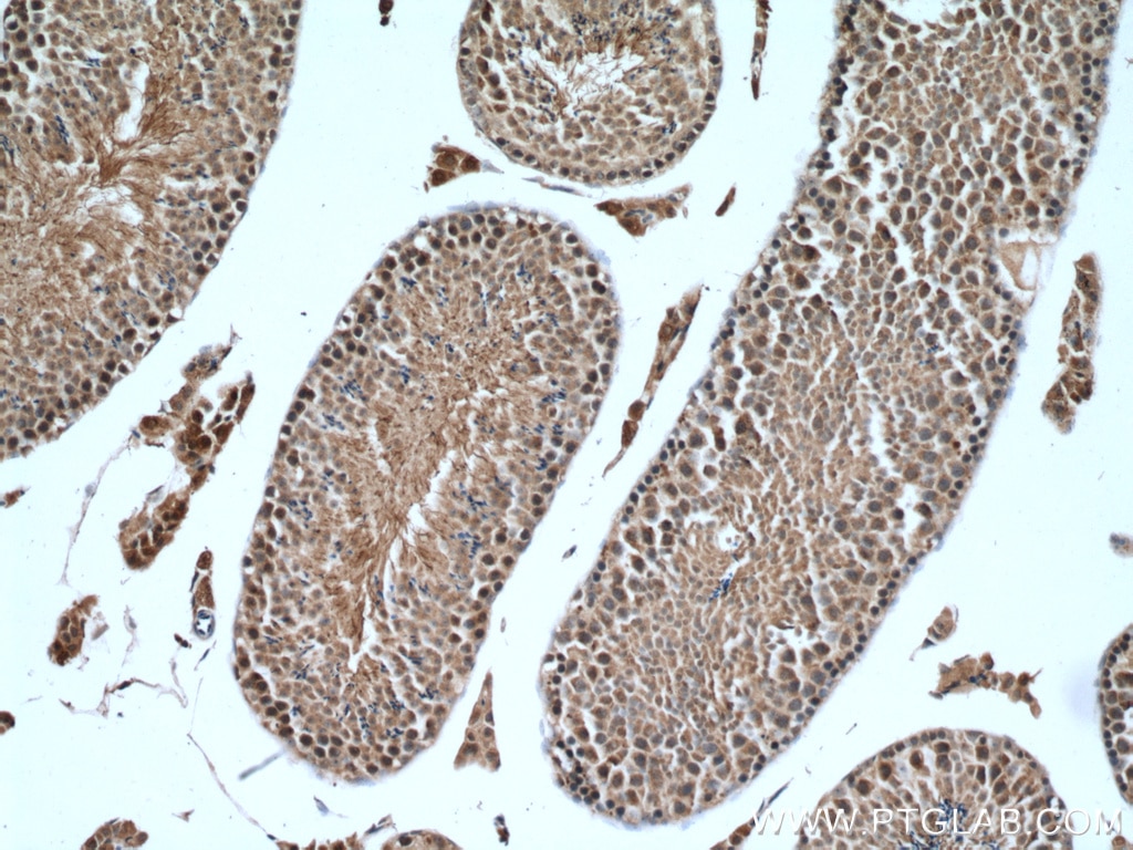 Immunohistochemistry (IHC) staining of mouse testis tissue using WRAP53 Polyclonal antibody (14761-1-AP)