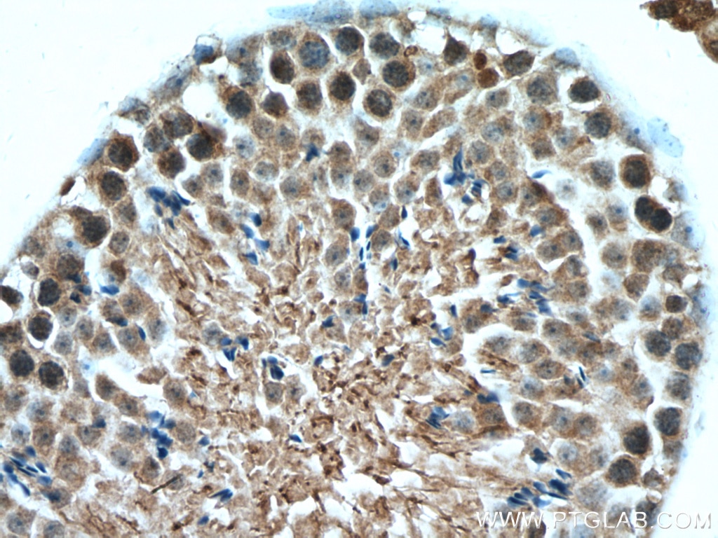 Immunohistochemistry (IHC) staining of mouse testis tissue using WRAP53 Polyclonal antibody (14761-1-AP)