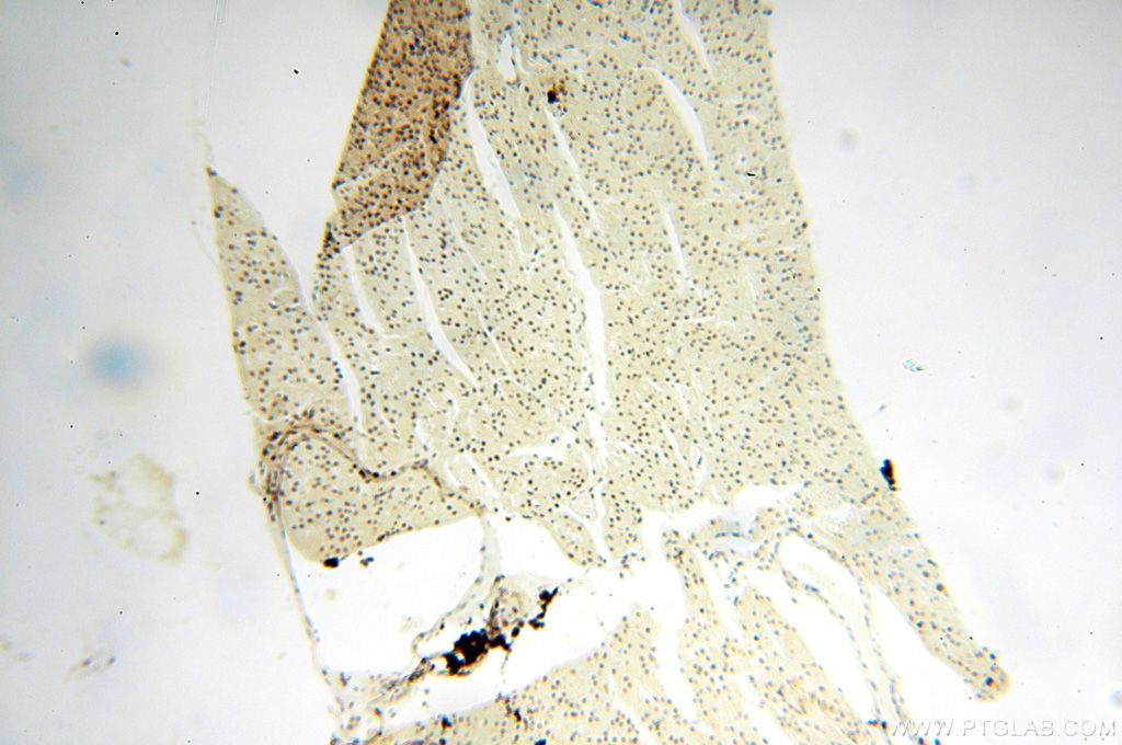 Immunohistochemistry (IHC) staining of human heart tissue using WRAP53 Polyclonal antibody (14761-1-AP)