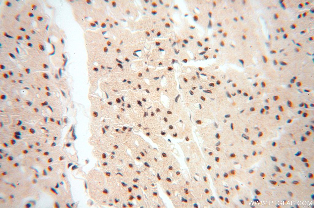 IHC staining of human heart using 14761-1-AP