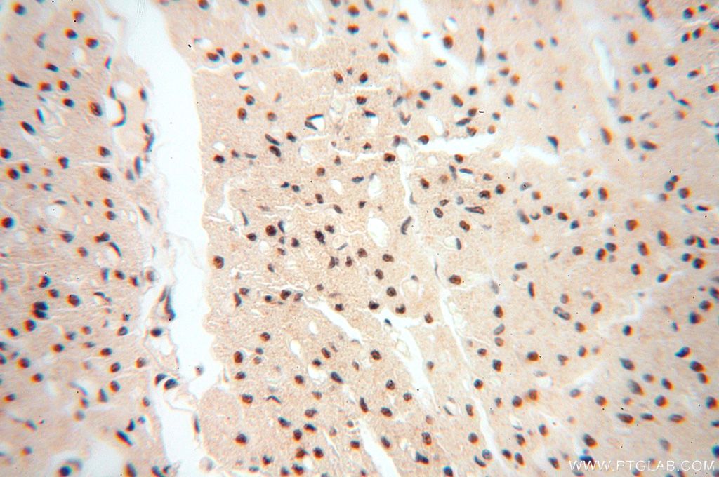 Immunohistochemistry (IHC) staining of human heart tissue using WRAP53 Polyclonal antibody (14761-1-AP)