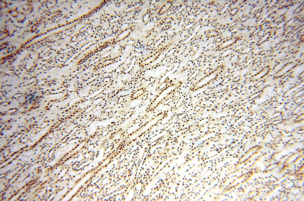 Immunohistochemistry (IHC) staining of human kidney tissue using WRAP53 Polyclonal antibody (14761-1-AP)