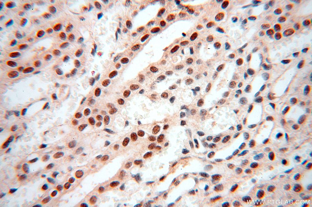 Immunohistochemistry (IHC) staining of human kidney tissue using WRAP53 Polyclonal antibody (14761-1-AP)