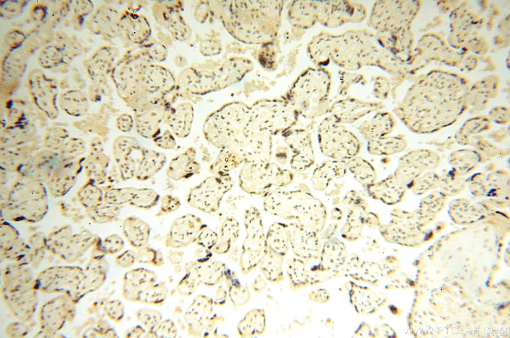 Immunohistochemistry (IHC) staining of human placenta tissue using WRAP53 Polyclonal antibody (14761-1-AP)