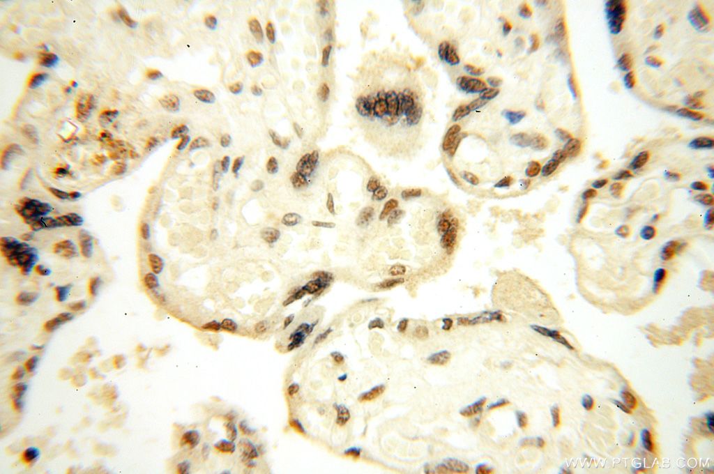 IHC staining of human placenta using 14761-1-AP