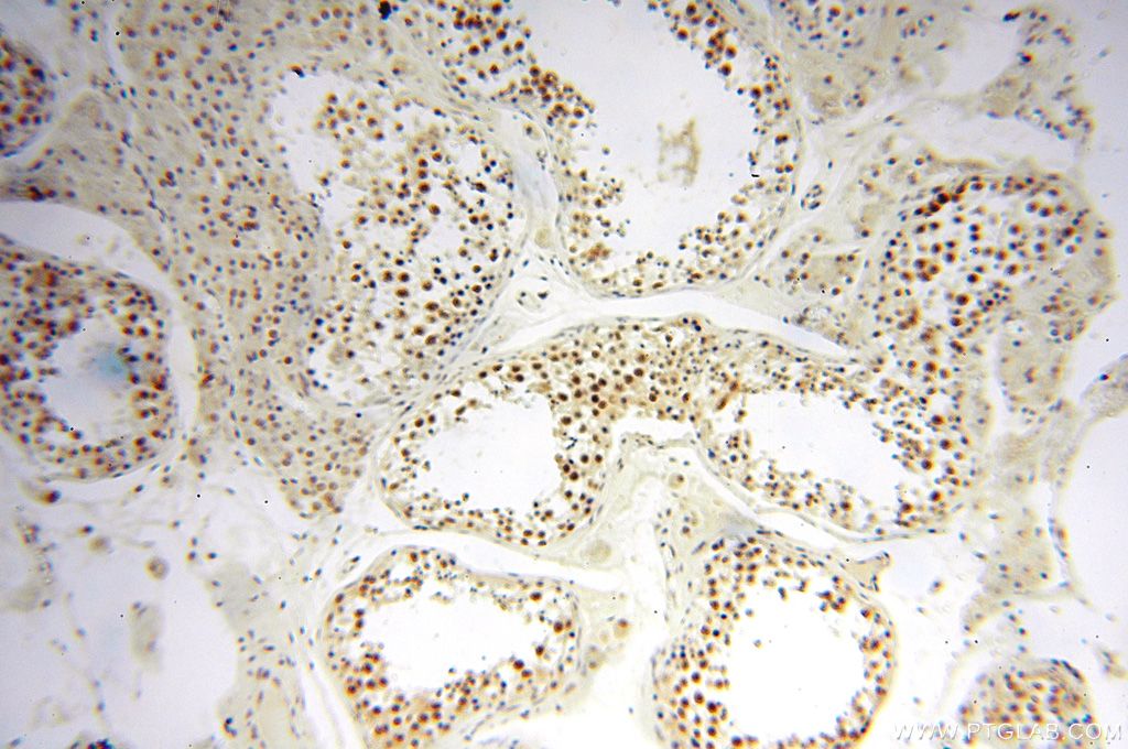 Immunohistochemistry (IHC) staining of human testis tissue using WRAP53 Polyclonal antibody (14761-1-AP)