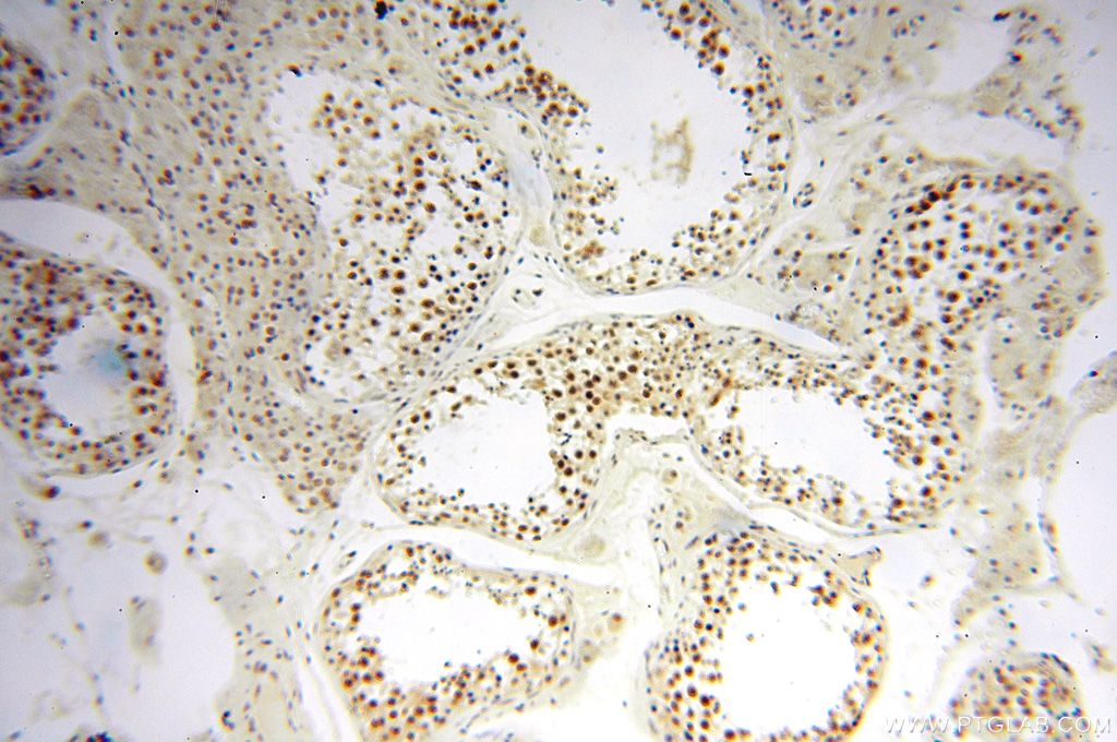 IHC staining of human testis using 14761-1-AP