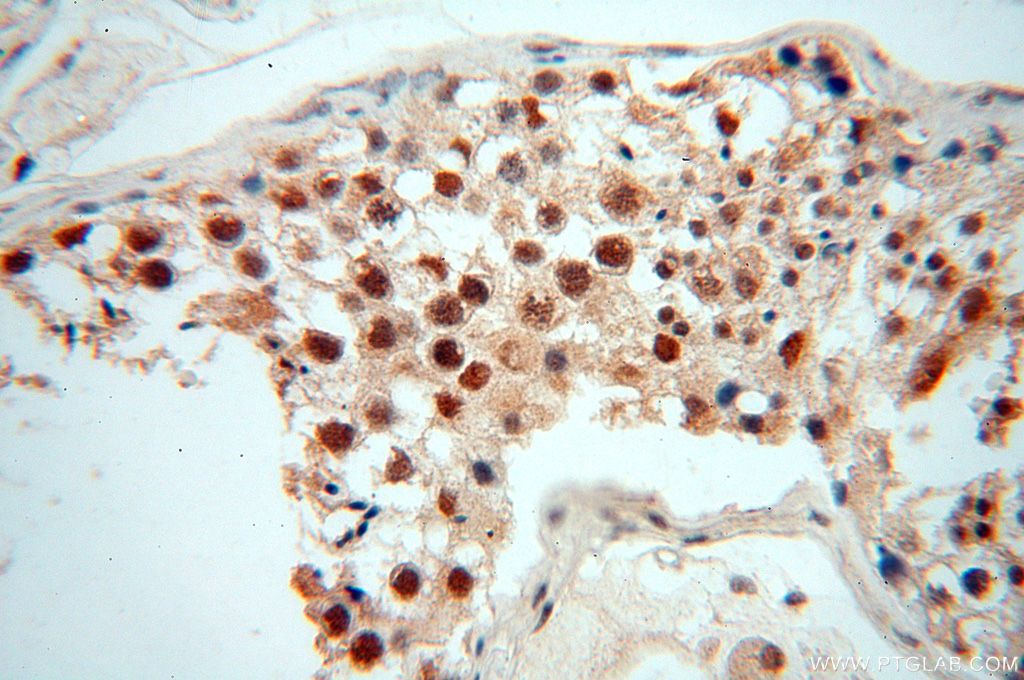 Immunohistochemistry (IHC) staining of human testis tissue using WRAP53 Polyclonal antibody (14761-1-AP)