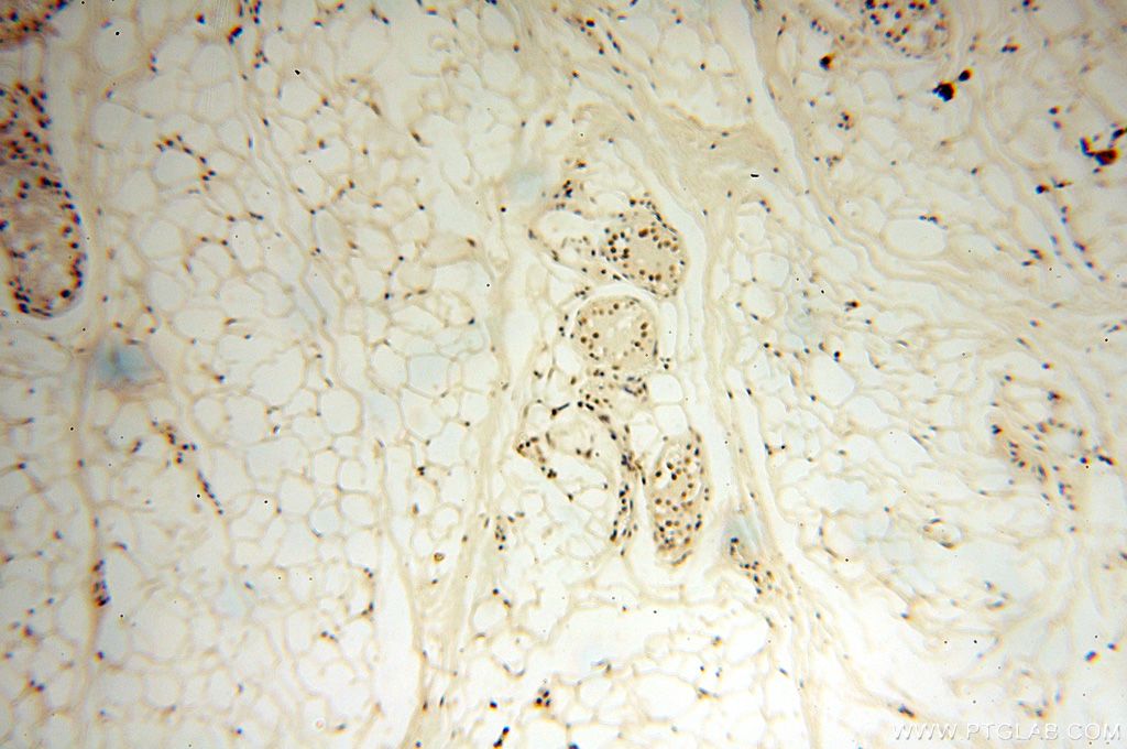 Immunohistochemistry (IHC) staining of human skin tissue using WRAP53 Polyclonal antibody (14761-1-AP)