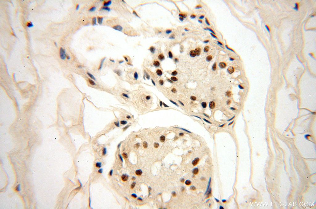 Immunohistochemistry (IHC) staining of human skin tissue using WRAP53 Polyclonal antibody (14761-1-AP)