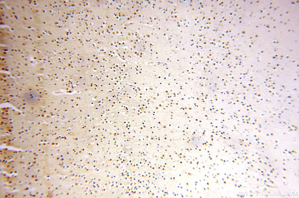 Immunohistochemistry (IHC) staining of human brain tissue using WRAP53 Polyclonal antibody (14761-1-AP)