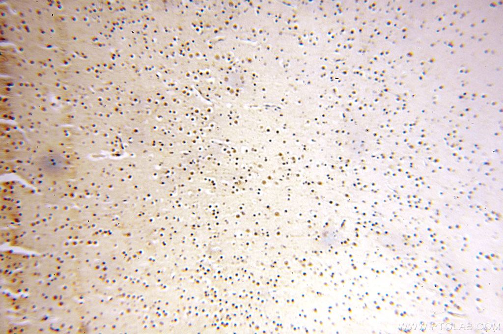 IHC staining of human brain using 14761-1-AP