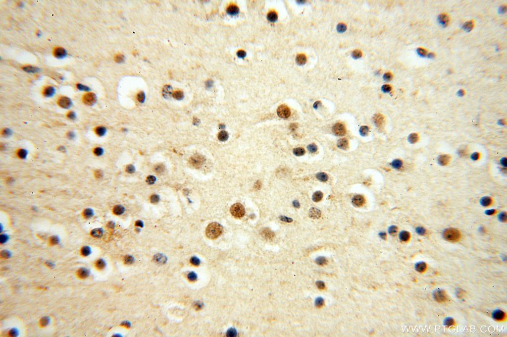 IHC staining of human brain using 14761-1-AP