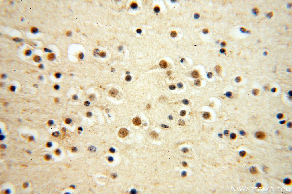 Immunohistochemistry (IHC) staining of human brain tissue using WRAP53 Polyclonal antibody (14761-1-AP)