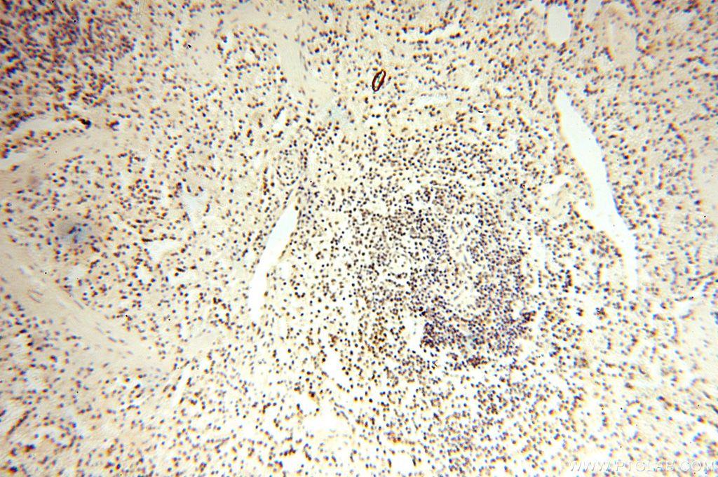 Immunohistochemistry (IHC) staining of human spleen tissue using WRAP53 Polyclonal antibody (14761-1-AP)