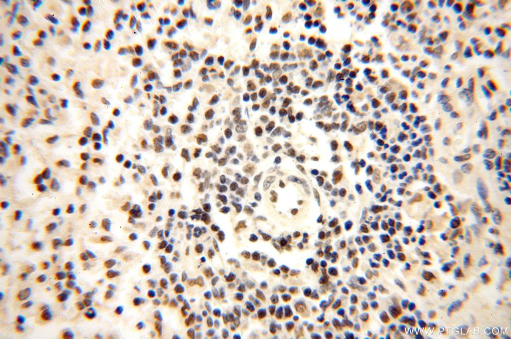 Immunohistochemistry (IHC) staining of human spleen tissue using WRAP53 Polyclonal antibody (14761-1-AP)