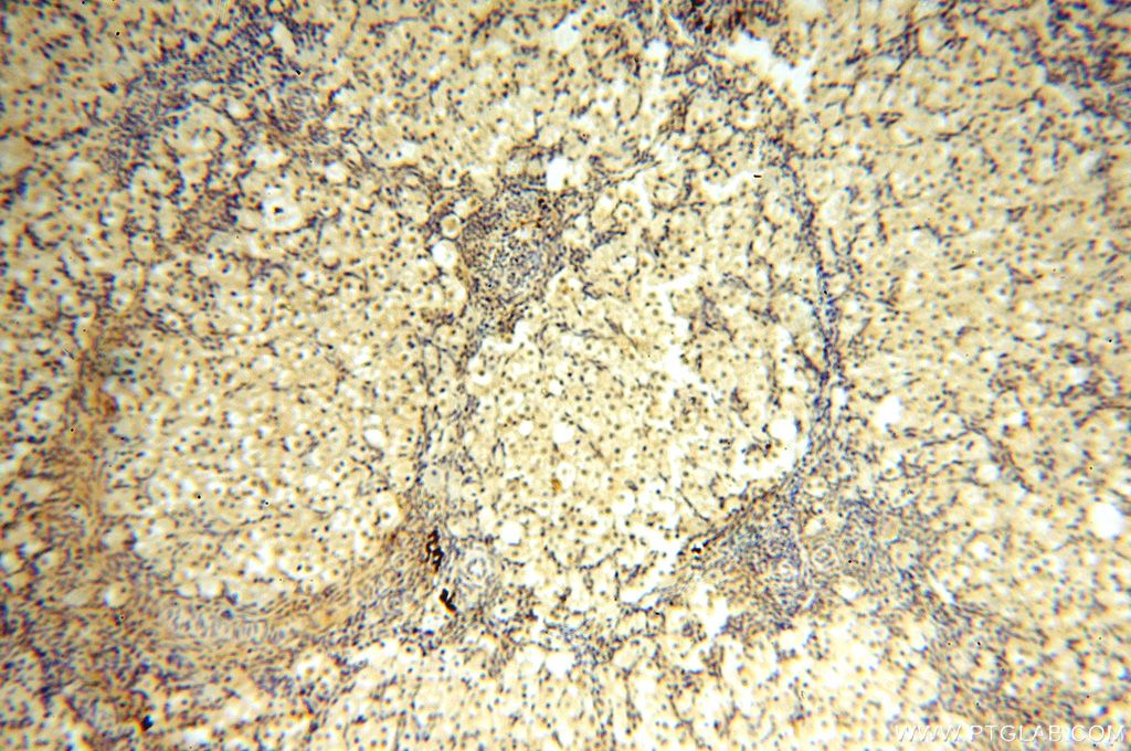 IHC staining of human ovary using 14761-1-AP