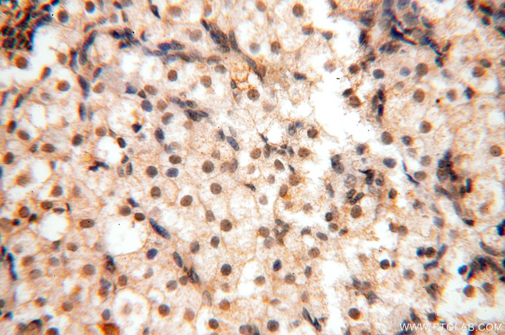 Immunohistochemistry (IHC) staining of human ovary tissue using WRAP53 Polyclonal antibody (14761-1-AP)