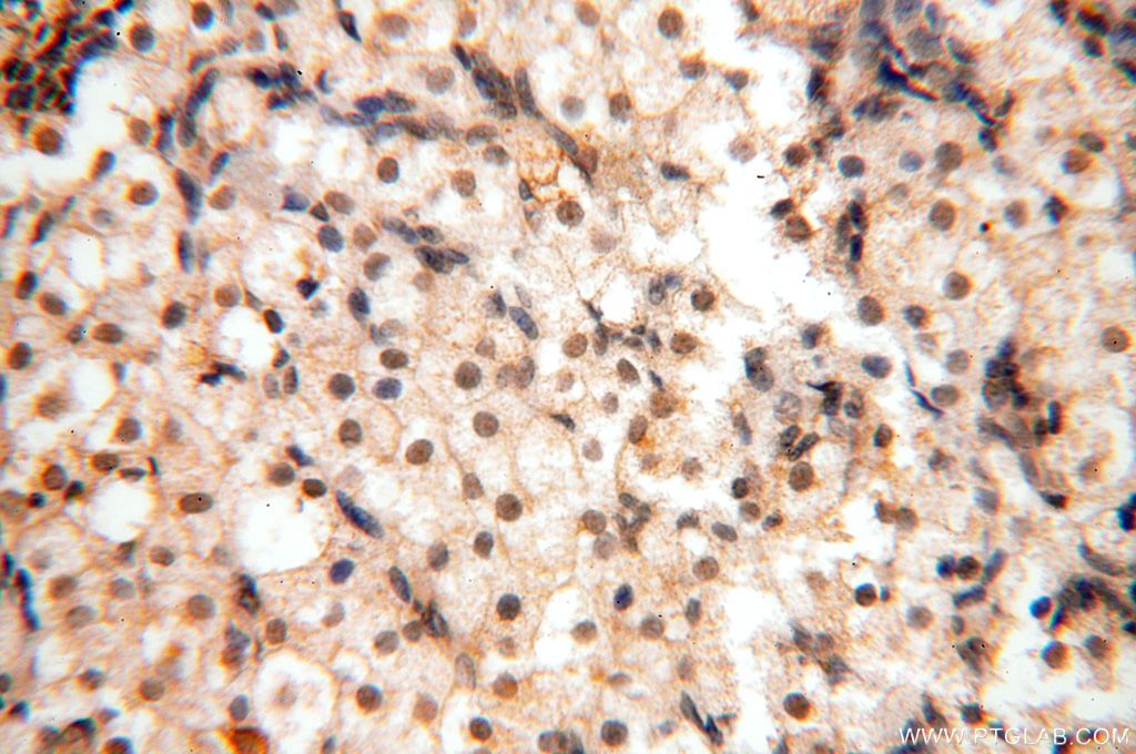 IHC staining of human ovary using 14761-1-AP