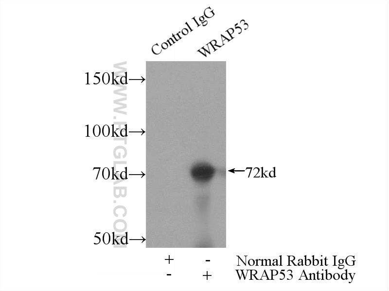 Immunoprecipitation (IP) experiment of HeLa cells using WRAP53 Polyclonal antibody (14761-1-AP)