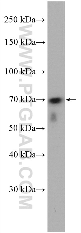 Western Blot (WB) analysis of HeLa cells using WRAP53 Polyclonal antibody (14761-1-AP)