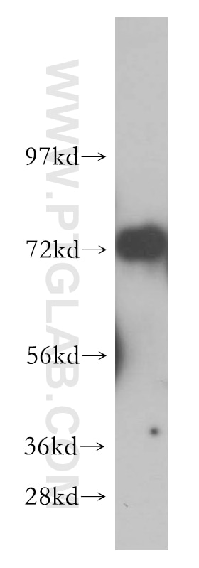 Western Blot (WB) analysis of human kidney tissue using WRAP53 Polyclonal antibody (14761-1-AP)
