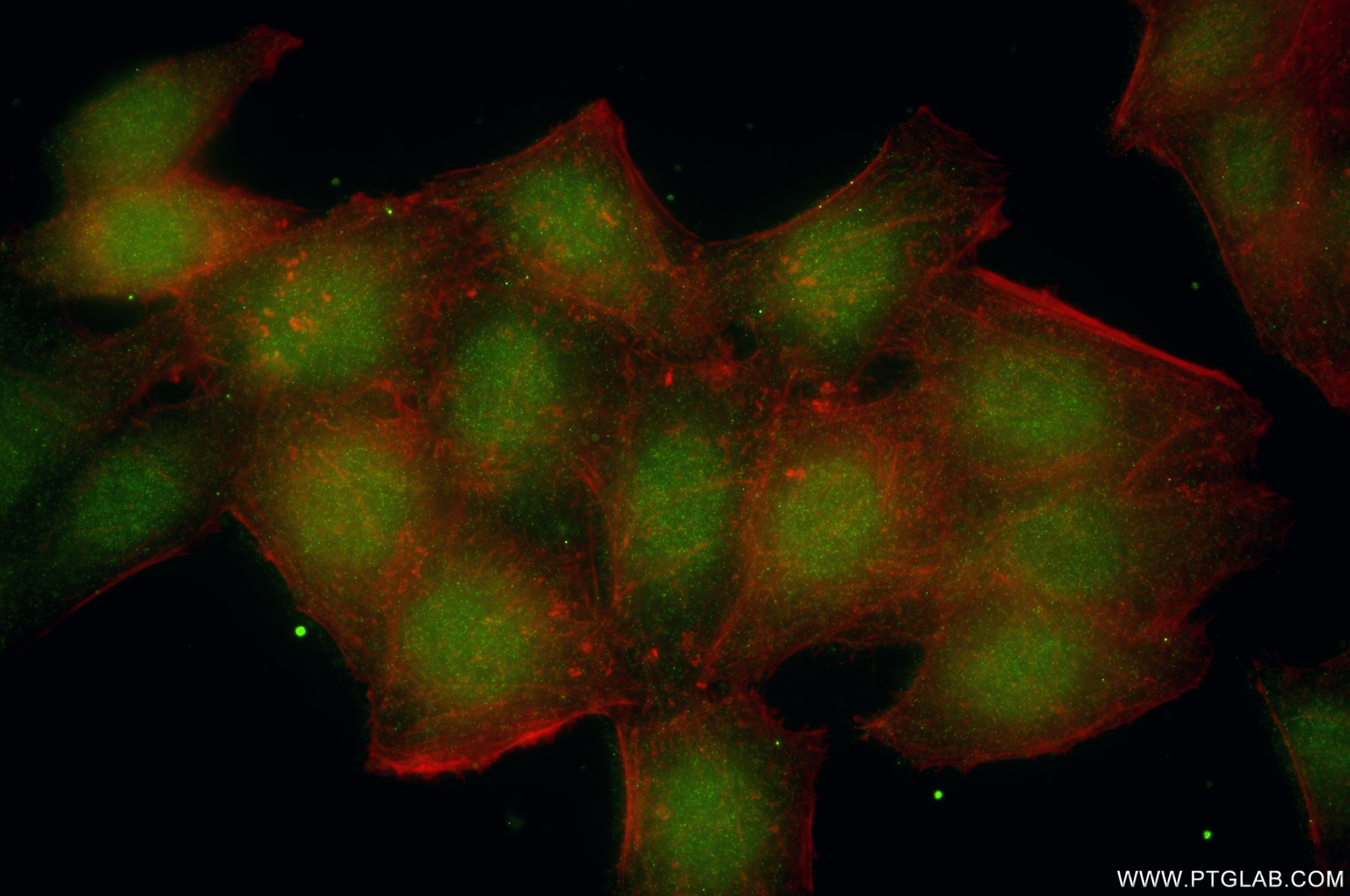 Immunofluorescence (IF) / fluorescent staining of HepG2 cells using WRAP53 Recombinant monoclonal antibody (86487-1-RR)