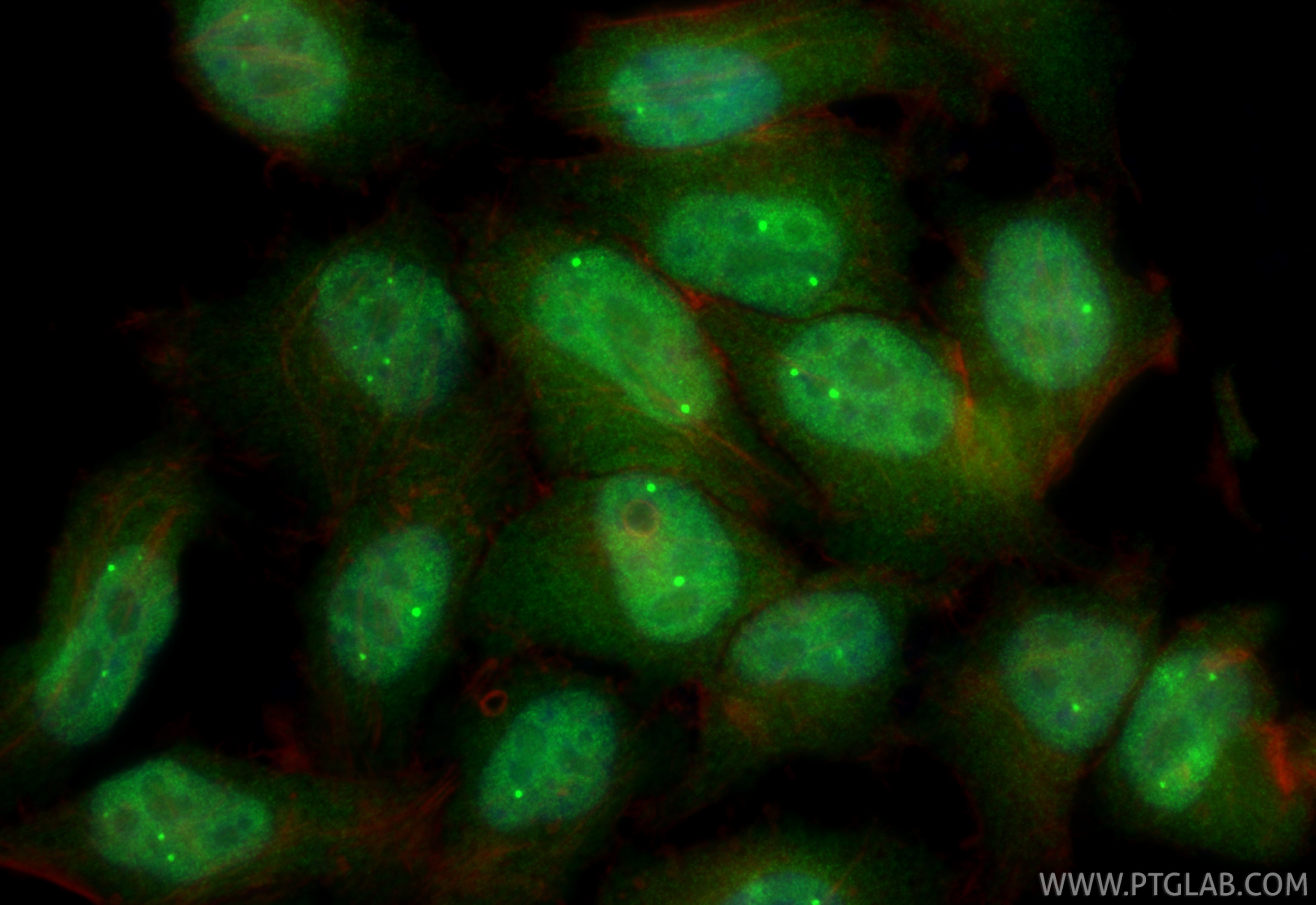IF Staining of HepG2 using RMX00057 Immunofluorescence (IF) / fluorescent staining of HepG2 cells using Multi-rAb® WRAP53 Multi-Recombinant antibody (RMX00057)