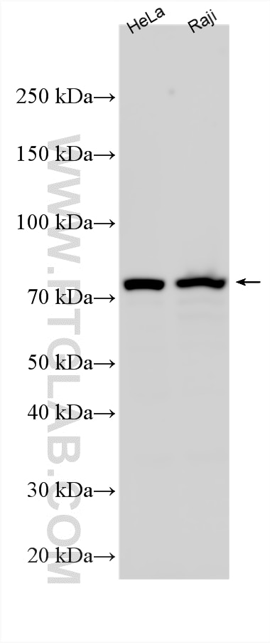 WB analysis using RMX00057 Western Blot (WB) analysis of various lysates using Multi-rAb® WRAP53 Multi-Recombinant antibody (RMX00057)