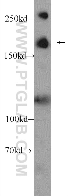 Western Blot (WB) analysis of HEK-293 cells using WRN Polyclonal antibody (25269-1-AP)