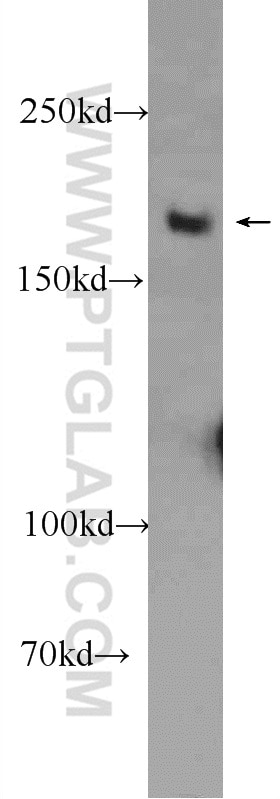 Western Blot (WB) analysis of MCF-7 cells using WRN Polyclonal antibody (25269-1-AP)