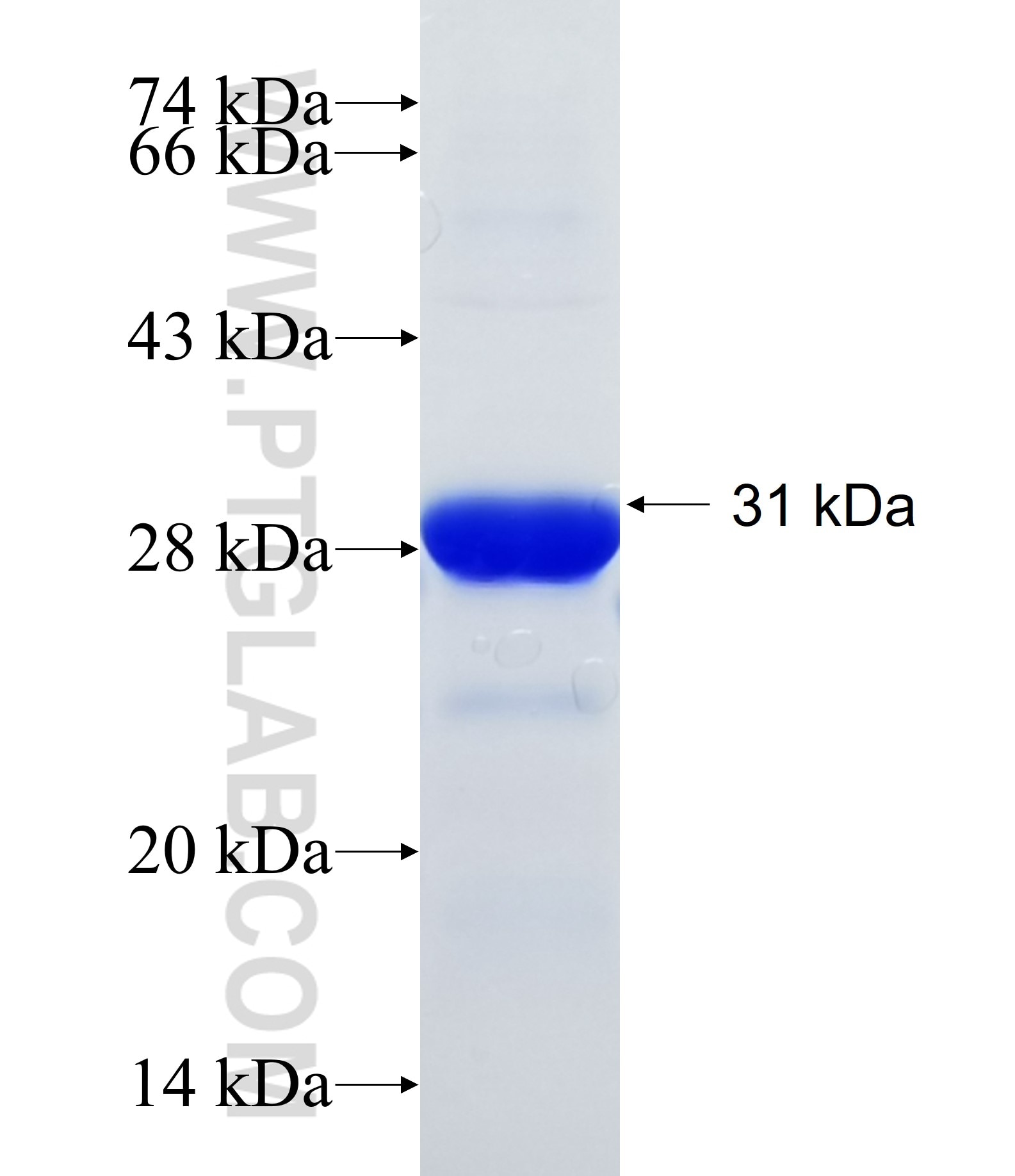 WRN fusion protein Ag34369 SDS-PAGE WRN fusion protein Ag34369 SDS-PAGE