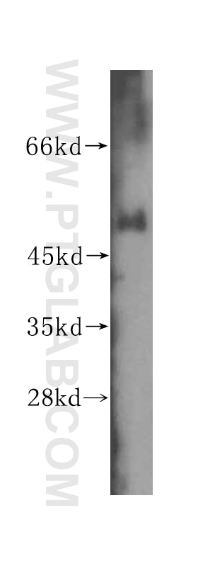 Western Blot (WB) analysis of human colon tissue using WRNIP1 Polyclonal antibody (16238-1-AP)