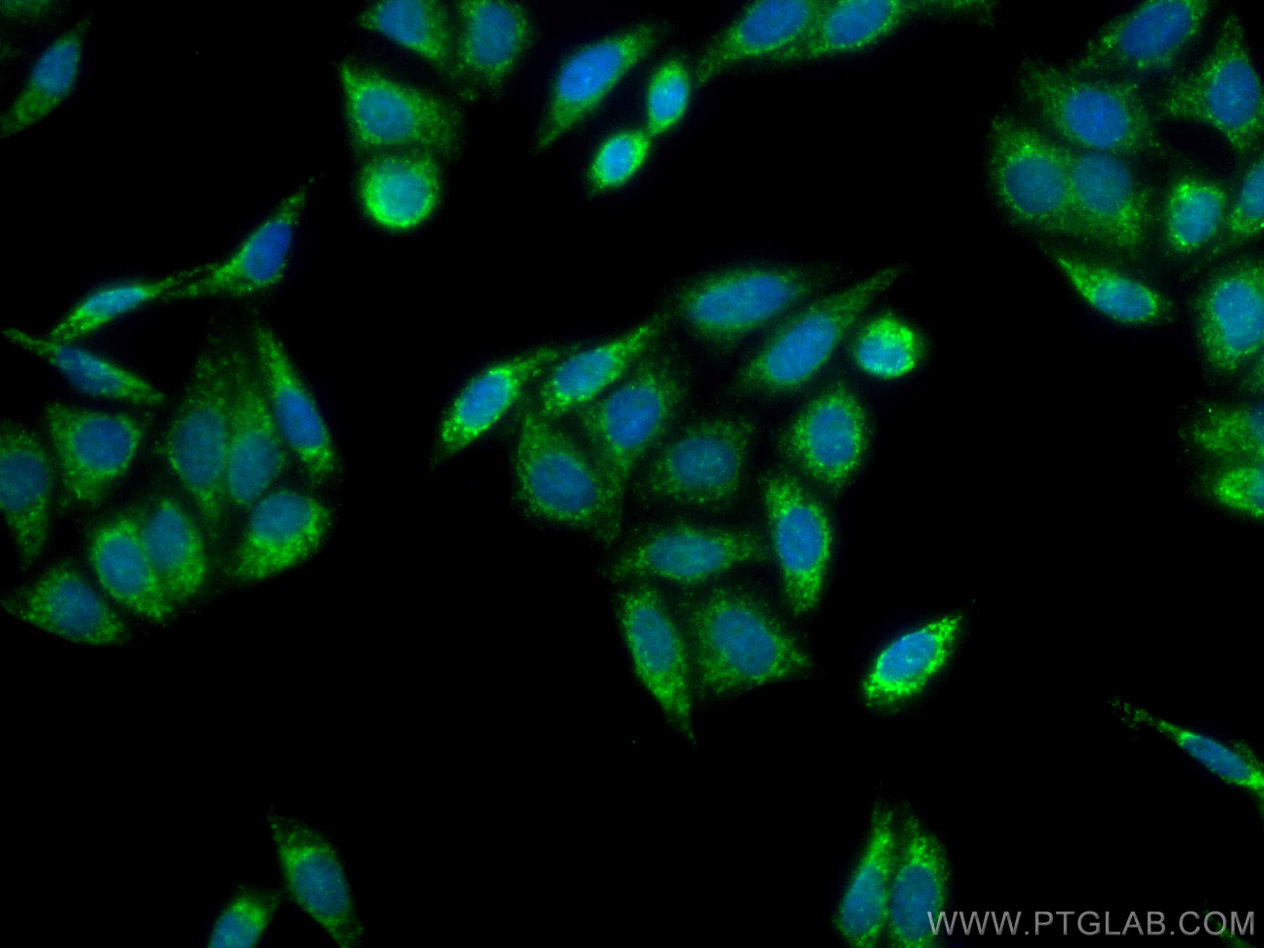 Immunofluorescence (IF) / fluorescent staining of HepG2 cells using WSB1 Polyclonal antibody (11666-1-AP)