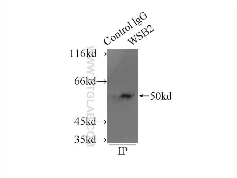 Immunoprecipitation (IP) experiment of mouse kidney tissue using WSB2 Polyclonal antibody (12124-2-AP)