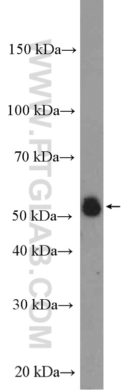 Western Blot (WB) analysis of rat kidney tissue using WSB2 Polyclonal antibody (12124-2-AP)