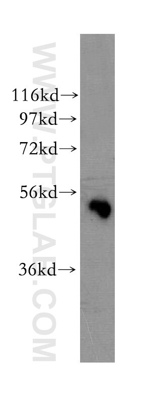 Western Blot (WB) analysis of human brain tissue using WSB2 Polyclonal antibody (12124-2-AP)