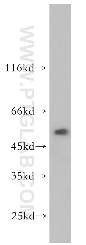 Western Blot (WB) analysis of mouse kidney tissue using WSB2 Polyclonal antibody (12124-2-AP)