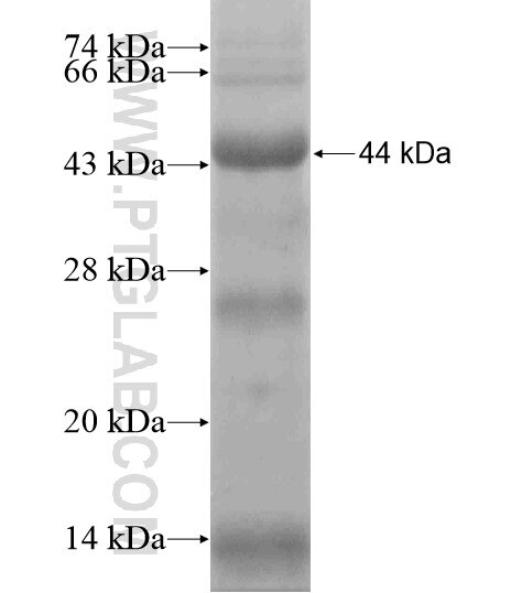 WSCD2 fusion protein Ag19495 SDS-PAGE