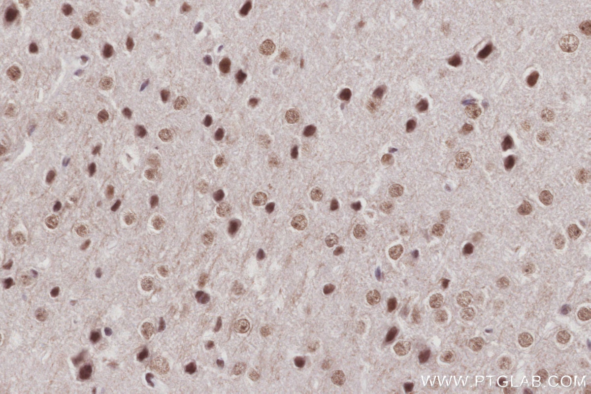 IHC staining of mouse brain using 26641-1-AP Immunohistochemistry (IHC) staining of mouse brain tissue using WSTF Polyclonal antibody (26641-1-AP)