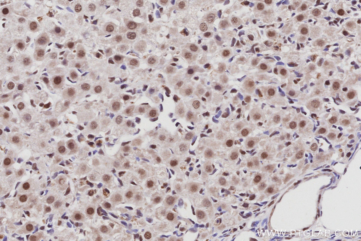IHC staining of rat ovary using 26641-1-AP Immunohistochemistry (IHC) staining of rat ovary tissue using WSTF Polyclonal antibody (26641-1-AP)