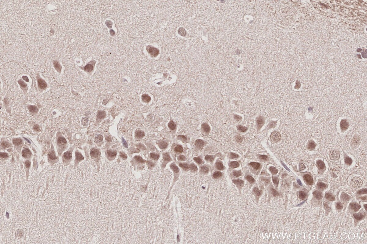 IHC staining of rat brain using 26641-1-AP Immunohistochemistry (IHC) staining of rat brain tissue using WSTF Polyclonal antibody (26641-1-AP)