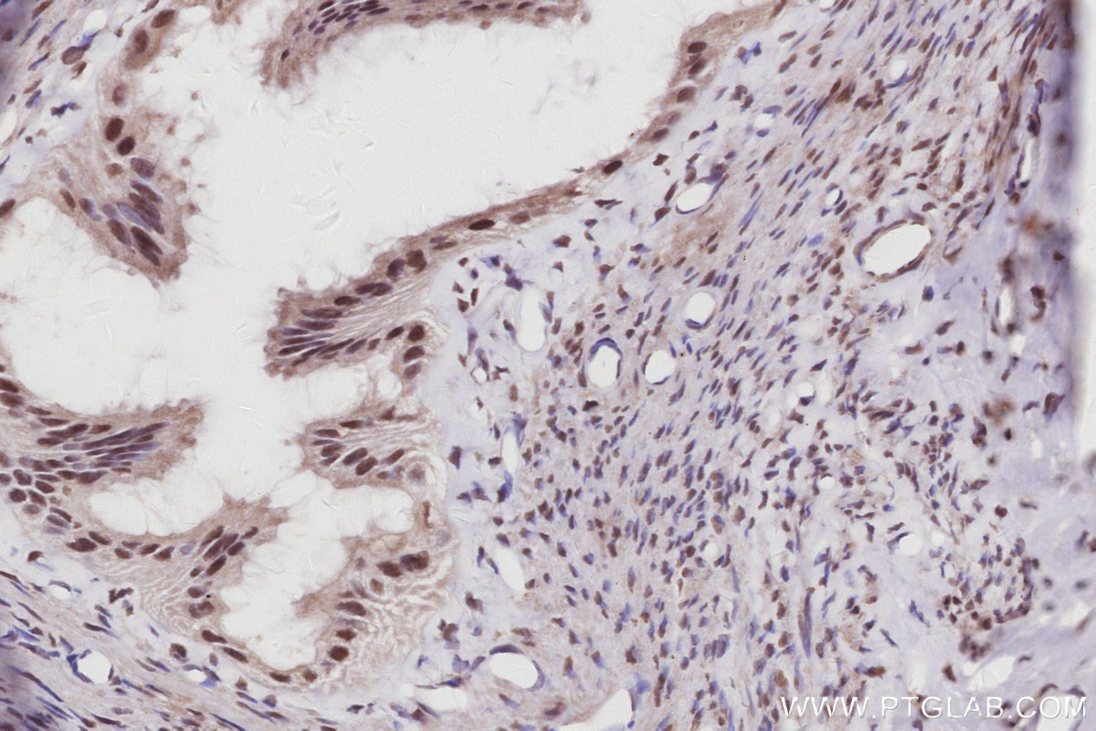 IHC staining of rat ovary using 26641-1-AP Immunohistochemistry (IHC) staining of rat ovary tissue using WSTF Polyclonal antibody (26641-1-AP)