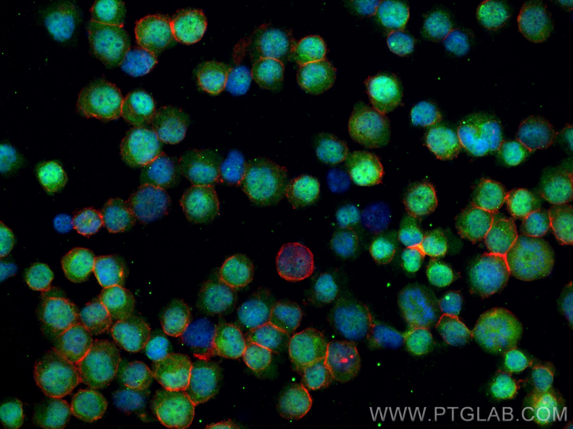 Immunofluorescence (IF) / fluorescent staining of K-562 cells using WT1 Polyclonal antibody (12609-1-AP)