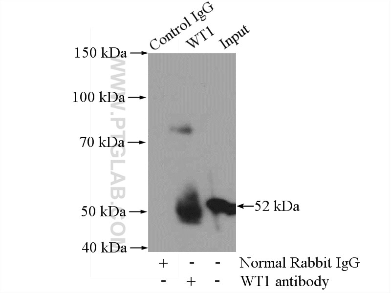 IP experiment of mouse kidney using 12609-1-AP
