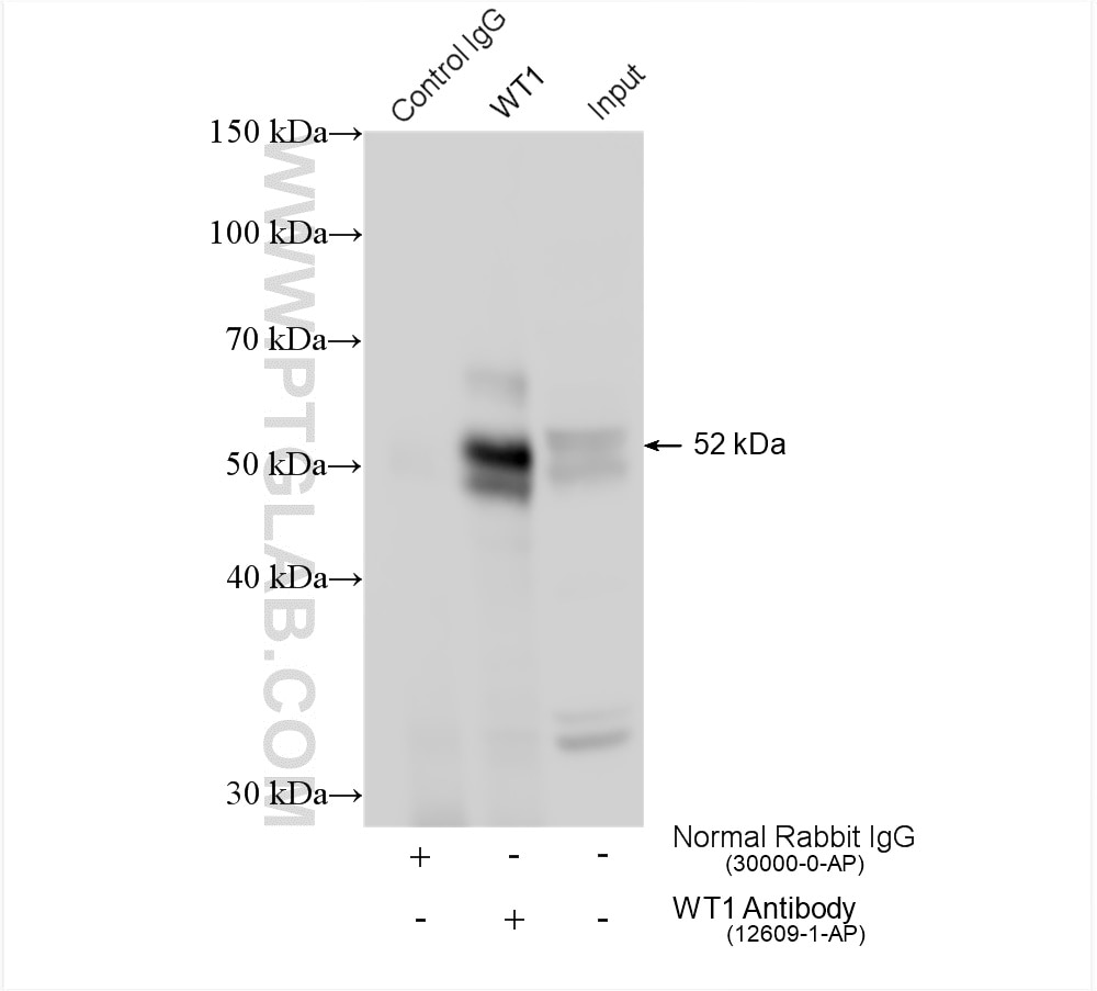 Immunoprecipitation (IP) experiment of K-562 cells using WT1 Polyclonal antibody (12609-1-AP)