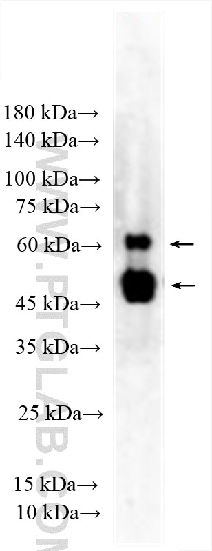 WB analysis of K-562 using 12609-1-AP