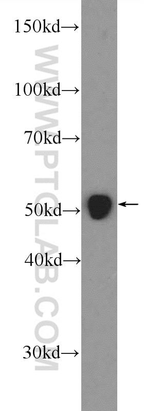 Western Blot (WB) analysis of rat kidney tissue using WT1 Polyclonal antibody (12609-1-AP)
