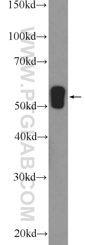 Western Blot (WB) analysis of mouse kidney tissue using WT1 Polyclonal antibody (12609-1-AP)