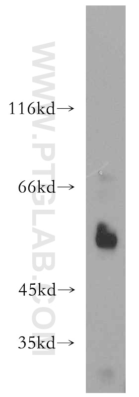 Western Blot (WB) analysis of K-562 cells using WT1 Polyclonal antibody (12609-1-AP)